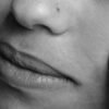 How Stress Affects Your Skin